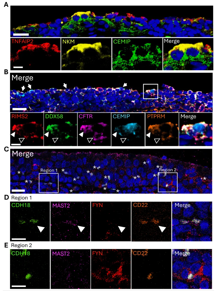 Mucosal Immunol.｜呼吸道感染 “防线” 藏在哪？人腺样体单细胞研究：拆解M细胞的免疫启动机制(图10)