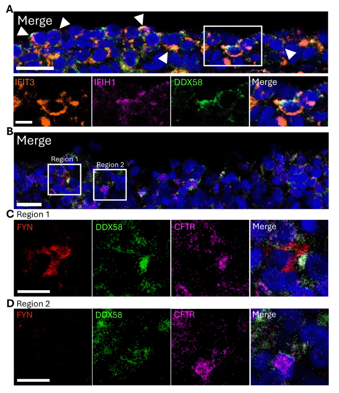Mucosal Immunol.｜呼吸道感染 “防线” 藏在哪？人腺样体单细胞研究：拆解M细胞的免疫启动机制(图7)