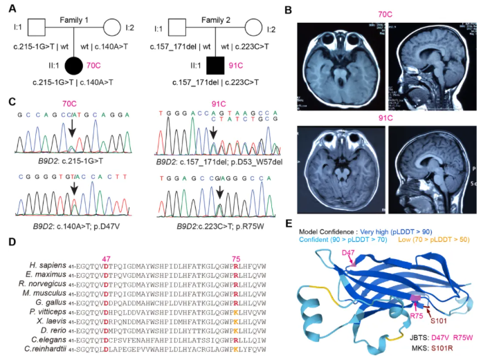 IF=13.6!上海交通大学曹木青老师团队新突破:B9复合体双功能解析,揭示纤毛病(JBTS/MKS)的分子分水岭!(图7) IF=13.6!上海交通大学曹木青老师团队新突破:B9复合体双功能解析,揭示纤毛病(JBTS/MKS)的分子分水岭!(图7)
