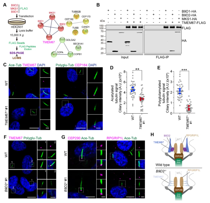 IF=13.6!上海交通大学曹木青老师团队新突破:B9复合体双功能解析,揭示纤毛病(JBTS/MKS)的分子分水岭!(图4) IF=13.6!上海交通大学曹木青老师团队新突破:B9复合体双功能解析,揭示纤毛病(JBTS/MKS)的分子分水岭!(图4)