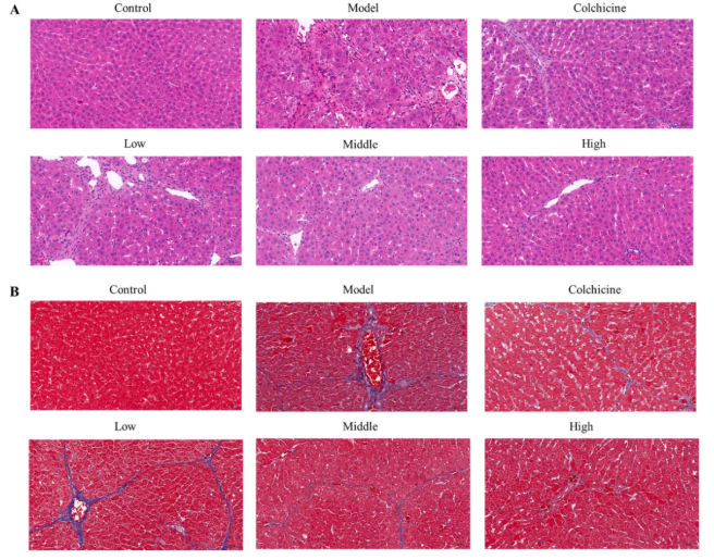 J Ethnopharmacol.|甘肃中医药大学张志红老师团队破解经典药对奥秘，精准阐释当归-白芍药对抗肝纤维化作用机制(图4)