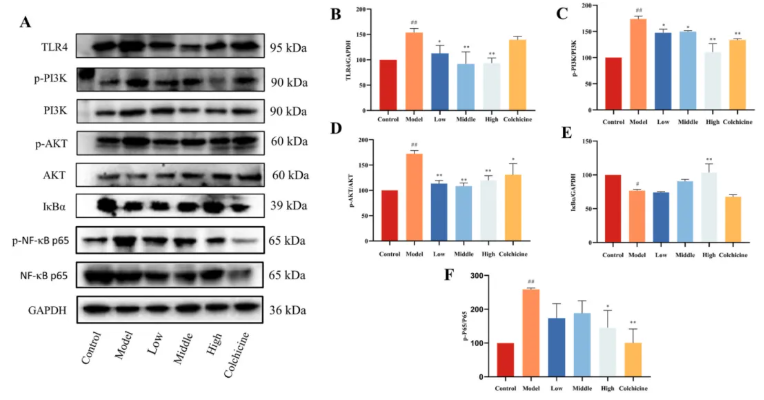 J Ethnopharmacol.|甘肃中医药大学张志红老师团队破解经典药对奥秘，精准阐释当归-白芍药对抗肝纤维化作用机制(图13)