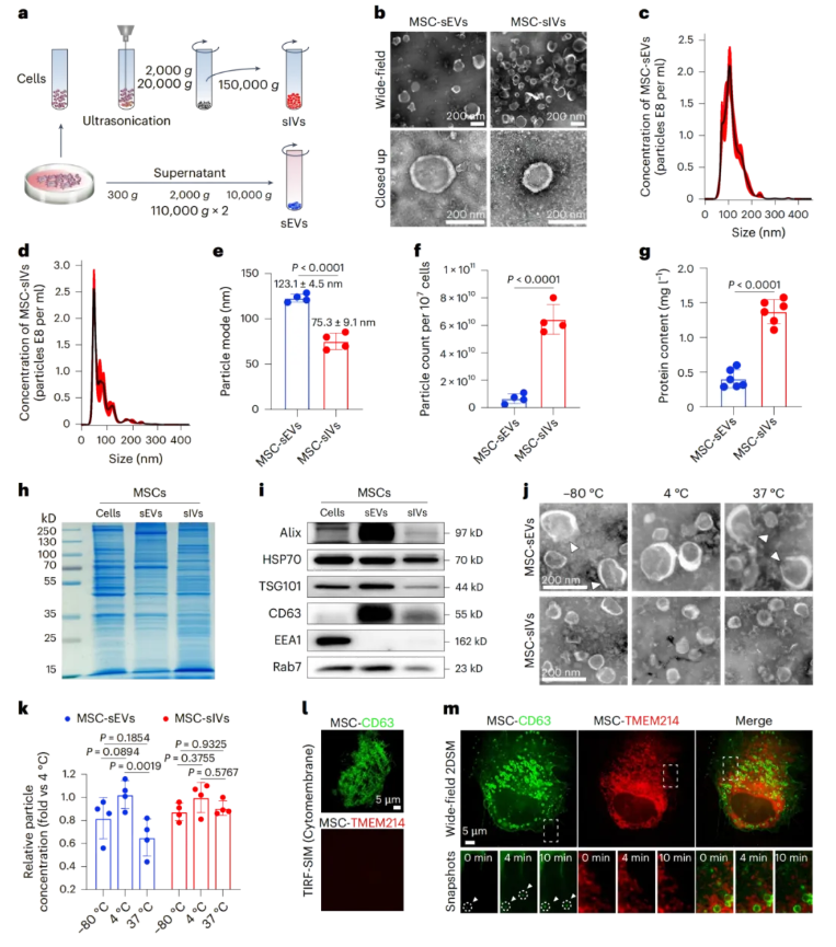 nature子刊(IF=26.6)|小小囊泡竟有大作用，天津医大眼科医院实现网膜保护+药物递送双突破(图3)