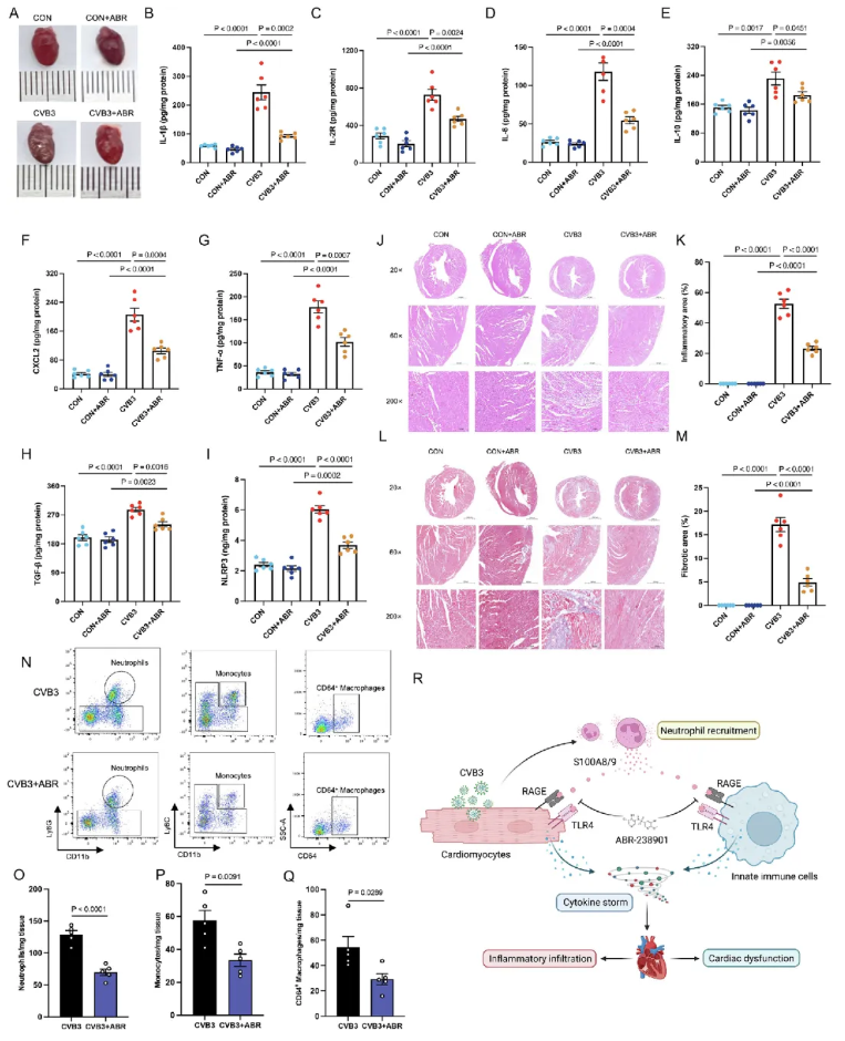 J.Adv.Res.(IF=13)|血浆蛋白质组学赋能：暴发性心肌炎精准诊断与靶向治疗新突破(图8)