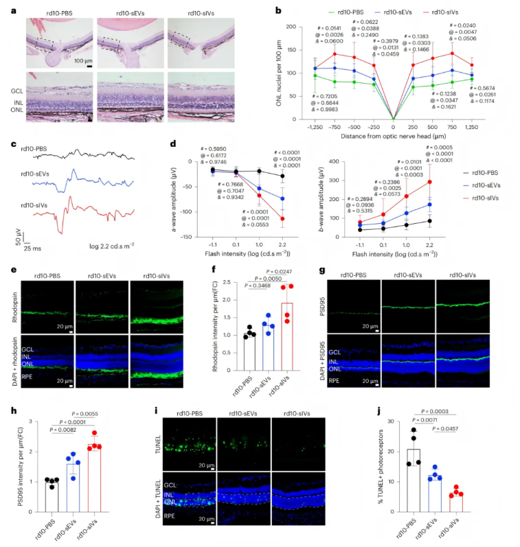 nature子刊(IF=26.6)|小小囊泡竟有大作用，天津医大眼科医院实现网膜保护+药物递送双突破(图7)