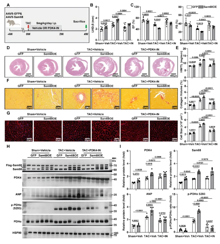 Circulation(IF=38.7)|南科大医学院覃刚健团队重大发现:靶向Sam68解锁心肌葡萄糖氧化,开启心衰代谢干预新策略(图7) Circulation(IF=38.7)|南科大医学院覃刚健团队重大发现:靶向Sam68解锁心肌葡萄糖氧化,开启心衰代谢干预新策略(图7)