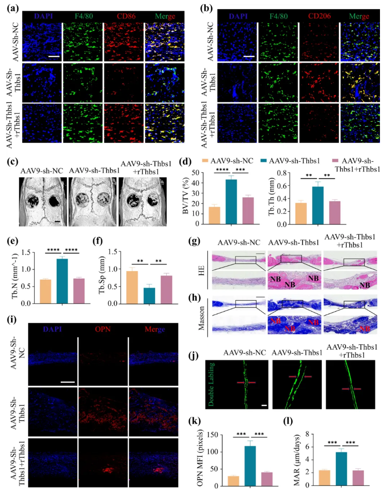 Aging Cell(IF=7.7)|福建医科大学陈江教授团队:揭秘衰老骨髓微环境恶性循环!Thbs1靶向破解老年骨再生难题(图10) Aging Cell(IF=7.7)|福建医科大学陈江教授团队:揭秘衰老骨髓微环境恶性循环!Thbs1靶向破解老年骨再生难题(图10)
