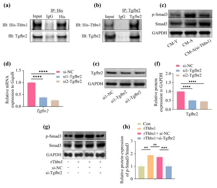 Aging Cell(IF=7.7)|福建医科大学陈江教授团队:揭秘衰老骨髓微环境恶性循环!Thbs1靶向破解老年骨再生难题(图6) Aging Cell(IF=7.7)|福建医科大学陈江教授团队:揭秘衰老骨髓微环境恶性循环!Thbs1靶向破解老年骨再生难题(图6)