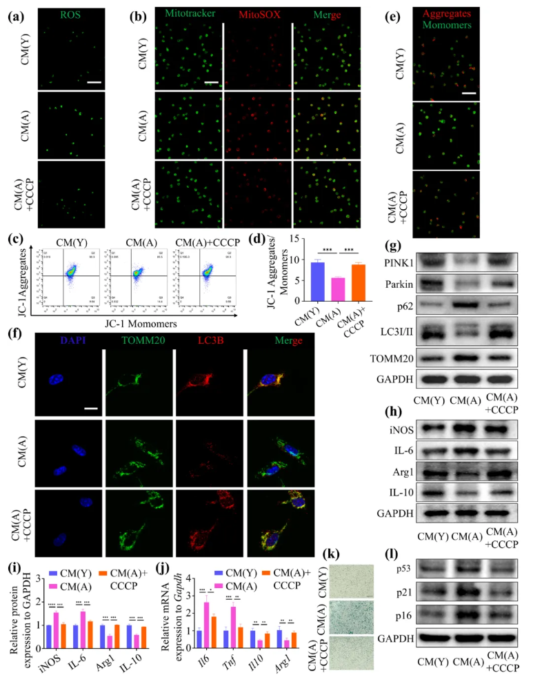Aging Cell(IF=7.7)|福建医科大学陈江教授团队:揭秘衰老骨髓微环境恶性循环!Thbs1靶向破解老年骨再生难题(图4) Aging Cell(IF=7.7)|福建医科大学陈江教授团队:揭秘衰老骨髓微环境恶性循环!Thbs1靶向破解老年骨再生难题(图4)